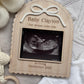 Personalised Pregancy Announcement Scan Holder Frame