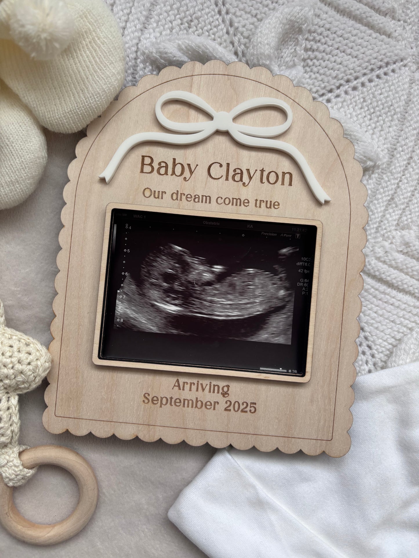 Personalised Pregancy Announcement Scan Holder Frame