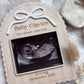 Personalised Pregancy Announcement Scan Holder Frame