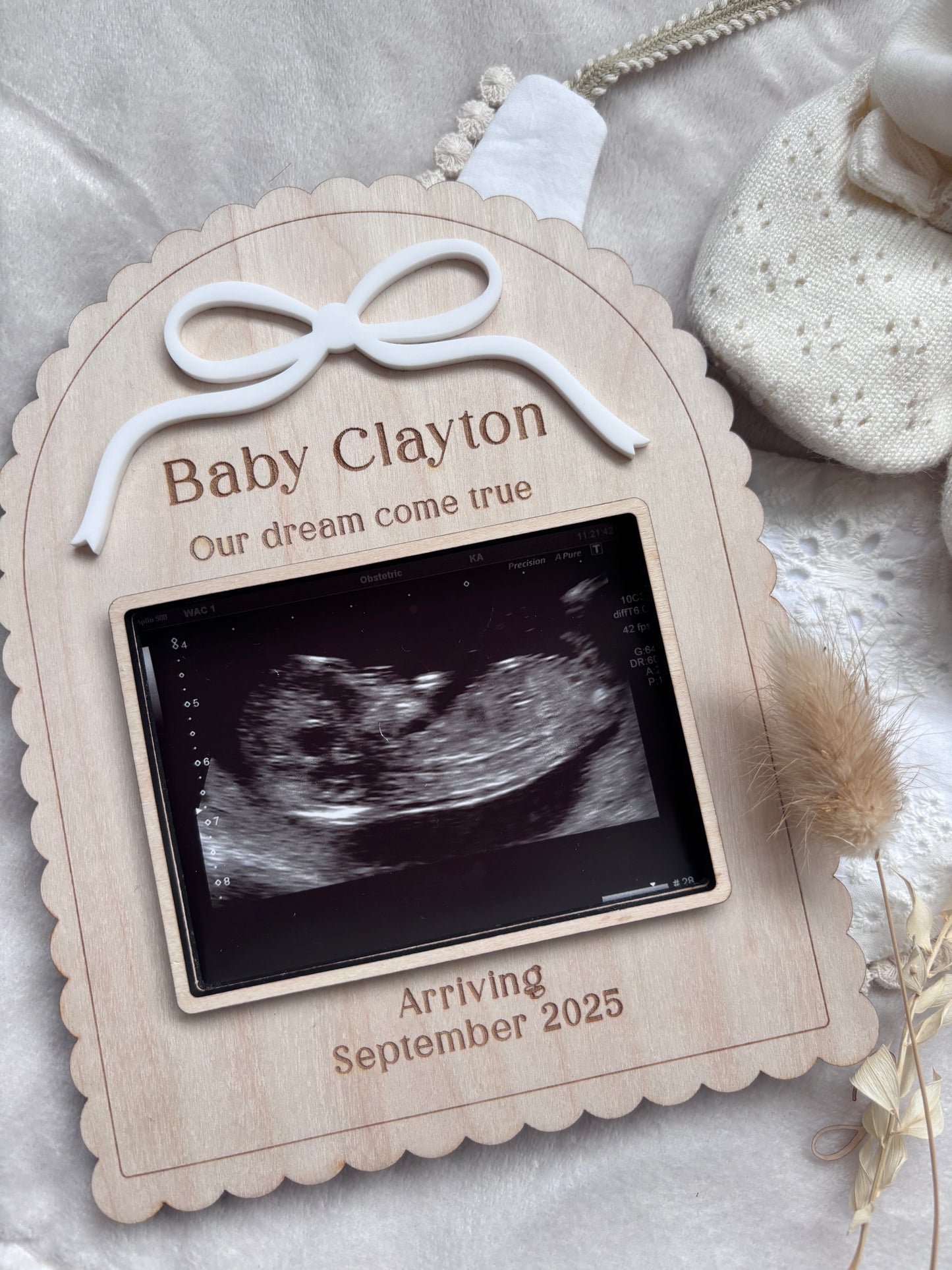 Personalised Pregancy Announcement Scan Holder Frame